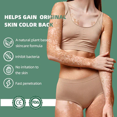 LAST DAY OF DISCOUNT ✨ Sumifun Vitiligo Treatment Cream 🌿