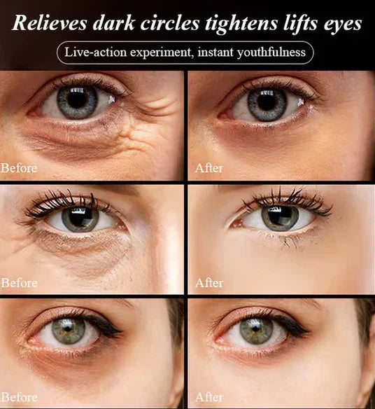 Last Day Of Discount 🔥 Anti Aging Eye Cream 💧