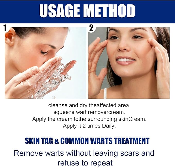 š„ Last Day Of Discount! Wart Remover Instant Blemish Removal Cream šāØ