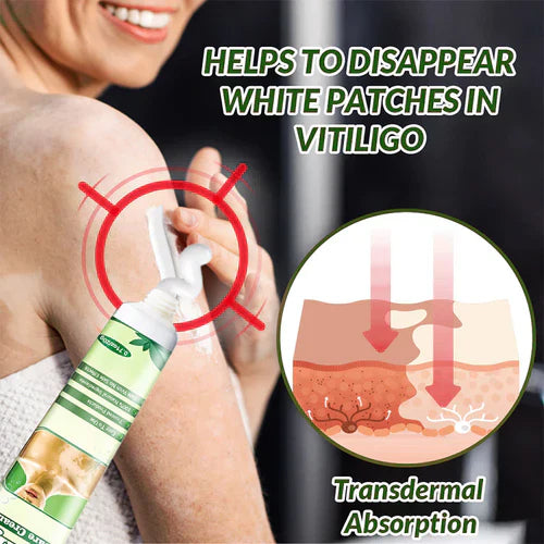 LAST DAY OF DISCOUNT ✨ Sumifun Vitiligo Treatment Cream 🌿
